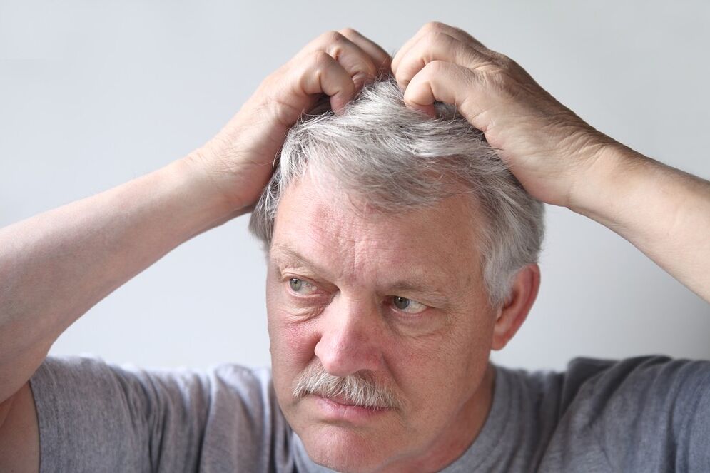 symptoms of psoriasis on the head