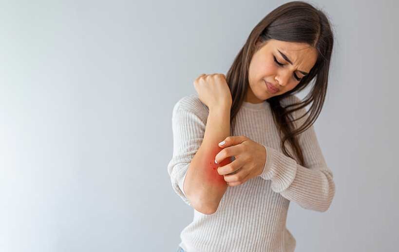 Psoriasis manifests itself in the form of skin rashes and itching