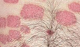 More pink formations on the stomach