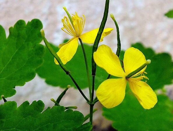 Celandine to treat psoriasis