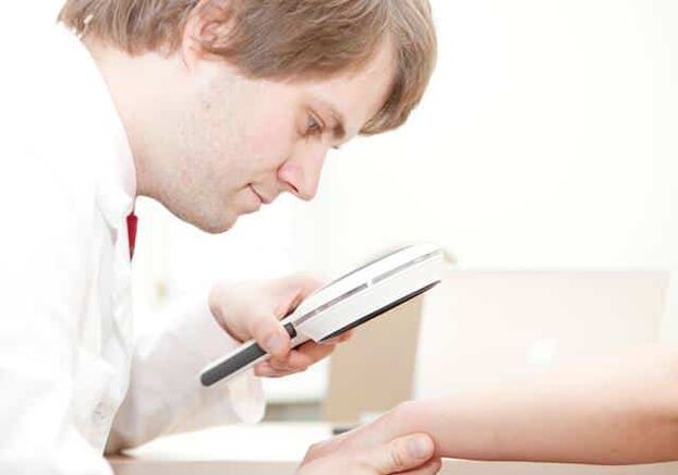 Psoriasis diagnosis by a dermatologist